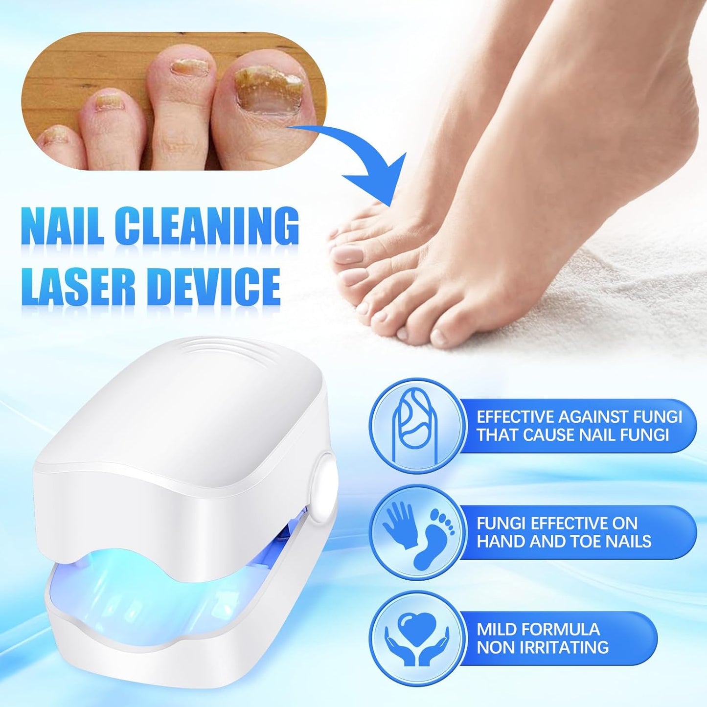 Rechargeable Nail Fungus Laser Device – Anti-Fungal Treatment for Hands & Feet (1 Pc)